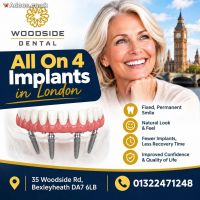 What is The Cost Of All On 4 Implants in London?
