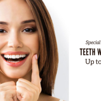 Best Teeth Whitening Cost in London - Prices start from £299*