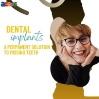 Dental implants - A permanent solution to missing teeth