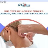 Disc Neck Replacement Surgery