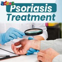 Can Psoriasis Be Reversed? Exploring Natural Healing Methods