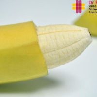 ZSR Circumcision in Ahmedabad | Dr. Paras Shah