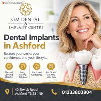 Where Can I Find a Good Place for Dental Implants in Ashford?