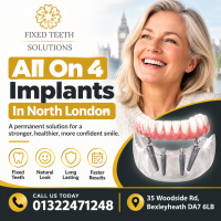 All On 4 Implants In North London – Fixed Teeth Solutions