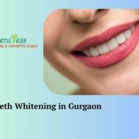 Teeth Whitening in Gurgaon | Artistree Dental and Cosmetic Clinic