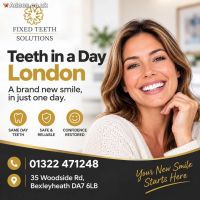Teeth in a Day London | Fixed Teeth Solutions