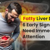Fatty Liver Disease: 6 Early Signs That Need Immediate Attention
