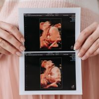 Trust an Ultrasound Clinic in Bristol for Accurate Pregnancy Tests