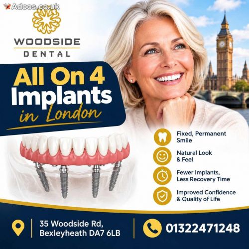 What is The Cost Of All On 4 Implants in London?