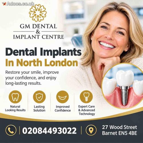 Why To Choose GM Dental For Dental Implants In North London?