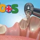 Permanent Solution For Your Missing Teeth At Eye Smile